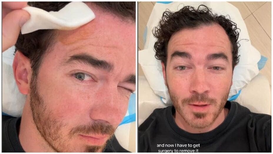 Video: Kevin Jonas, de los Jonas Brothers, revela su lucha contra el cáncer de piel
