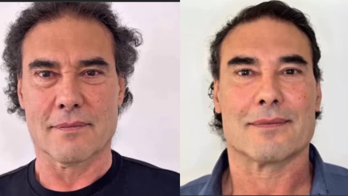 Actor Eduardo Yáñez se somete a cirugía de rejuvenecimiento facial y sorprende a fans