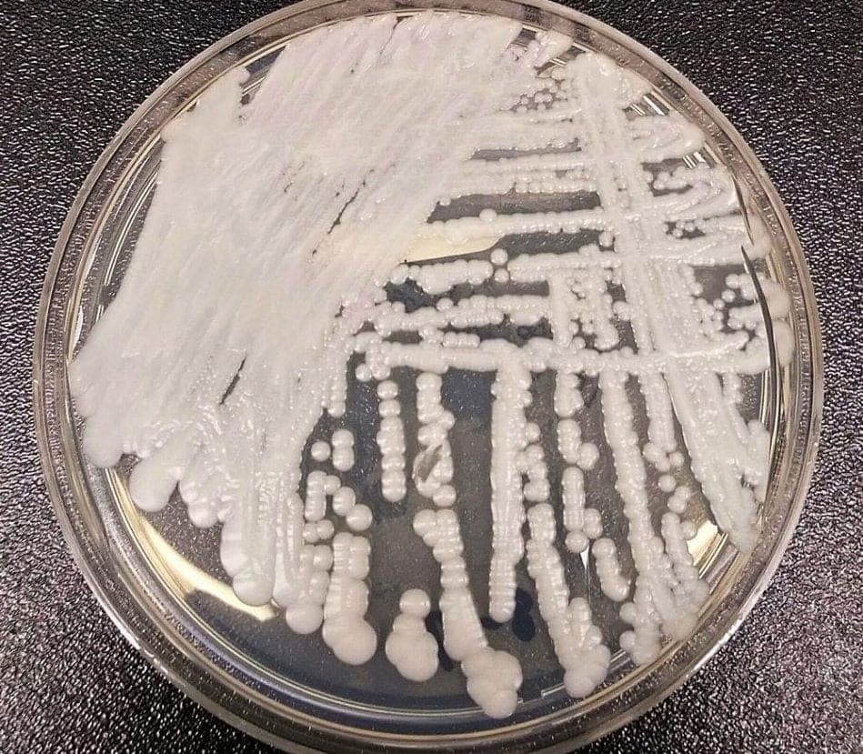 Reportan en Brasil posible caso de infección por 'Candida auris', un hongo peligroso