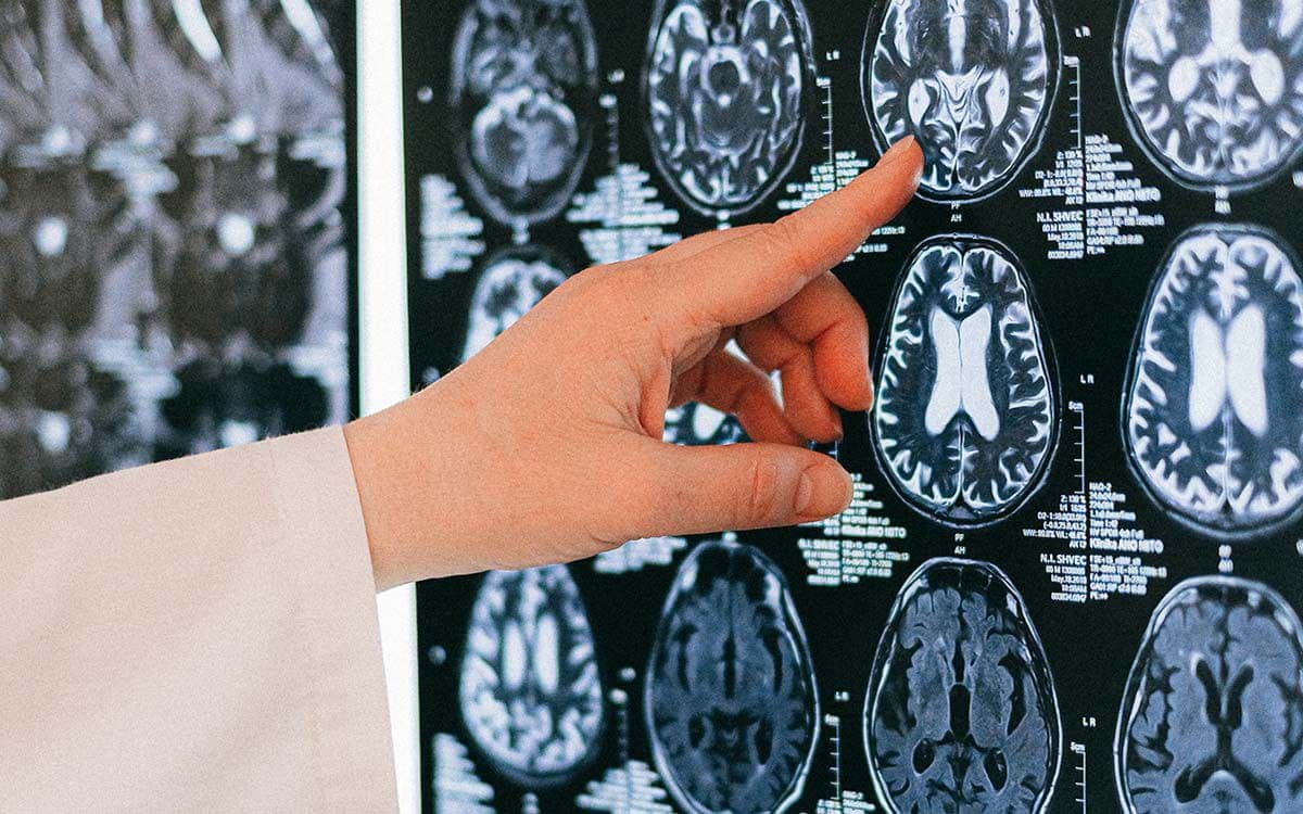 Crean primer 'atlas' de células cerebrales que ayudará a curar trastornos mentales