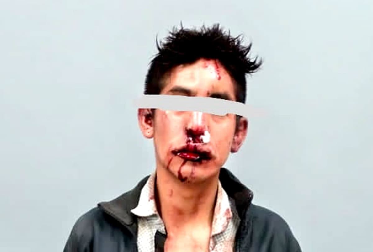 Mató a bebé, la “enmaletó”; vecinos casi lo linchan, pero huyó de hospital en la Cdmx